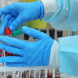 مبادرة مجموعة العشرين لتعليق مدفوعات خدمة الدين تستقبل 41 طلبًا