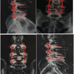 بعد غد.. الرياض تحتضن كبار مصنّعي ومطوّري لقاح كوفيد-١٩ بمنتدى الأبحاث الطبية الـ11
