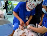 بدء عملية فصل التوأم الطفيلي اليمني في الرياض