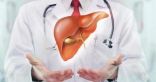 “فهد الطبية” توضح أعراض تضخم الكبد وطرق الوقاية منه