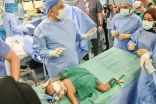 نجاح فصل التوأم السيامي النيجيري ” حسنة وحسينة ” بعد عملية جراحية معقدة استغرقت 16 ساعة ونصف