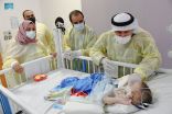 استقرار حالة التوأم السيامي العراقي (عمر وعلي) بعد 12 يوماً من إجراء عملية فصلهما الناجحة