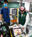 إجراء عملية فصل التوأم السيامي اليمني “مودة ورحمة” الخميس المقبل
