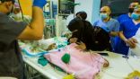الفريق الجراحي لفصل التوأم اليمني الملتصق بالرأس يعلنُ وفاة أحدهما