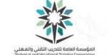 بدء التسجيل لبرنامج البكالوريوس المسائي لخريجي الدبلوم بتقنية الأحساء