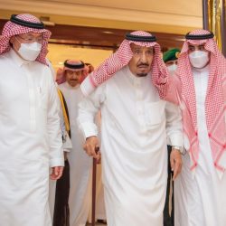 نجاح فصل التوأم السيامي اليمني “يوسف وياسين” الملتصقين بالرأس في عملية استغرقت 15 ساعة