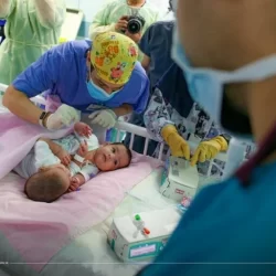 بالفيديو: الدكتور الربيعة يعلن نجاح فصل التوأم السيامي اليمني مودة ورحمة ودون أي مضاعفات