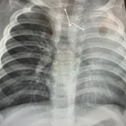 حرس الحدود السعودي يشارك في الملتقى البحري السعودي الدولي 