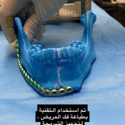 تقني تبوك يطلق المعرض التوعي الأول بأخطار المخدرات والمؤثرات العقلية