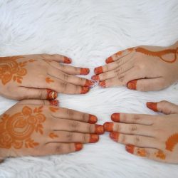 تخصصي بريدة ينجح بإعادة السمع لطفل بعمر السنتين