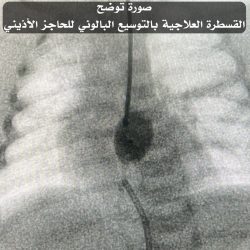 جمعية حياة تكرِّم رجل الأعمال “حسن الصعيري”*